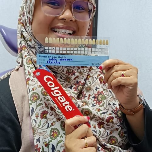patient whitening